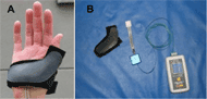 Photographs of the components of the custom forceglove. The components include a wheelchair glove, FlexiForce sensor embedded inside a metal cage, electronics box, and a data logger.